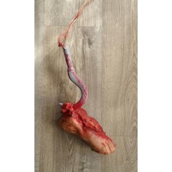 Pie Desgarrado con Gancho