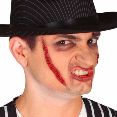 Cicatriz de Sutura con...